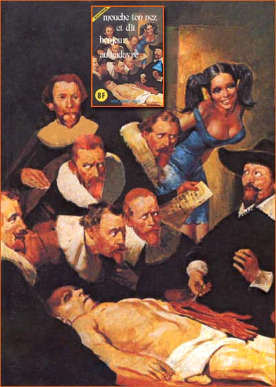 La leçon d'anatomie du docteur Nicolaes Tulp selon Elvifrance.