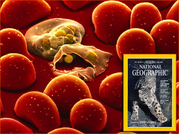 La Malaria par Nilsson pour National Geographic.